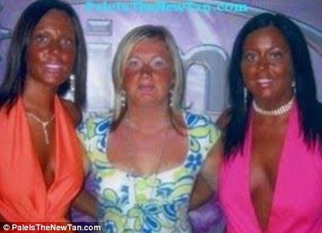 S-au stafidit de când tot stau la plajă. Şi-au bătut singuri joc de trupul lor. Exemple umane de &quot;aşa NU&quot; 141209