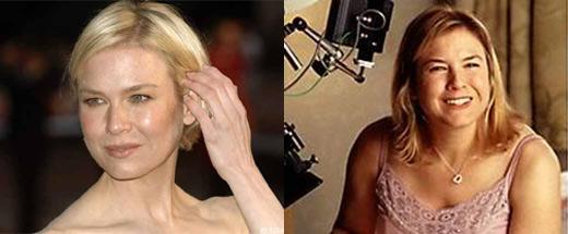 Viaţa lui nu a mai fost la fel după acestă experienţă. &quot;La fiecare respiraţie mi se vedeau coastele&quot; 144776