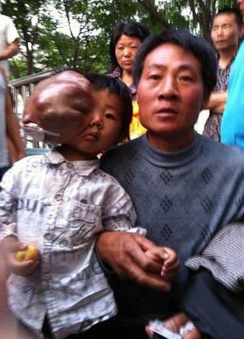 Sărăcia îi răpeşte dreptul la viaţă. Are numai cinci ani, dar şi-a pierdut speranţa 150205