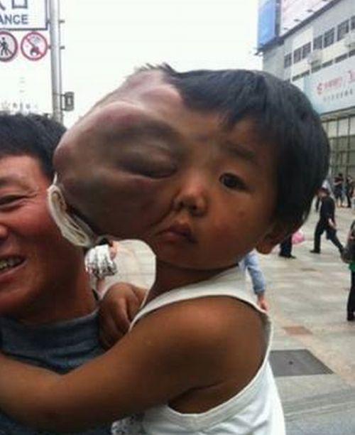 Sărăcia îi răpeşte dreptul la viaţă. Are numai cinci ani, dar şi-a pierdut speranţa 150206