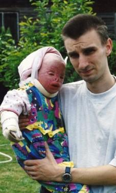 &quot;I-am nenorocit viaţa copilei mele! Pompierii au crezut că este o păpusă arsă&quot;. Povestea şocantă a copilei cu chipul topit 151658