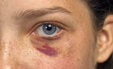 O femeie din Argeş a fost bătută şi sechestrată. Fiul său îl acuză pe primar