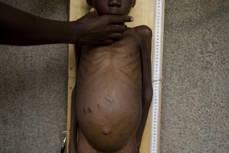 Provocarea: Foamete zero. &quot;Într-o lume a abundenţei, nici o singură persoană nu trebuie să fie înfometată” 153086