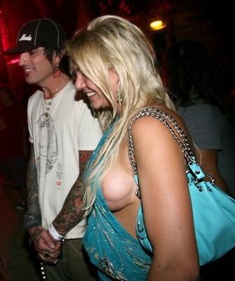 &quot;Zici că au bolovani în loc de sâni&quot;. Distruse de operaţia care trebuia să le facă mai sexy 153526