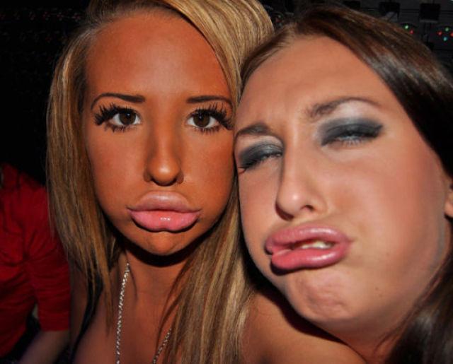 Buzele la înaintare! Originea boticurilor de răţuşcă, un sindrom al bolilor mintale 155325