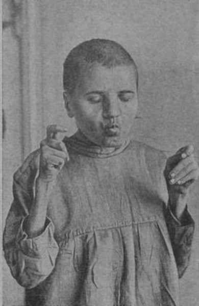 Buzele la înaintare! Originea boticurilor de răţuşcă, un sindrom al bolilor mintale 155326