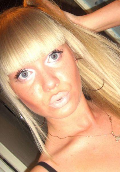 Buzele la înaintare! Originea boticurilor de răţuşcă, un sindrom al bolilor mintale 155329