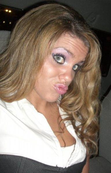 Buzele la înaintare! Originea boticurilor de răţuşcă, un sindrom al bolilor mintale 155331