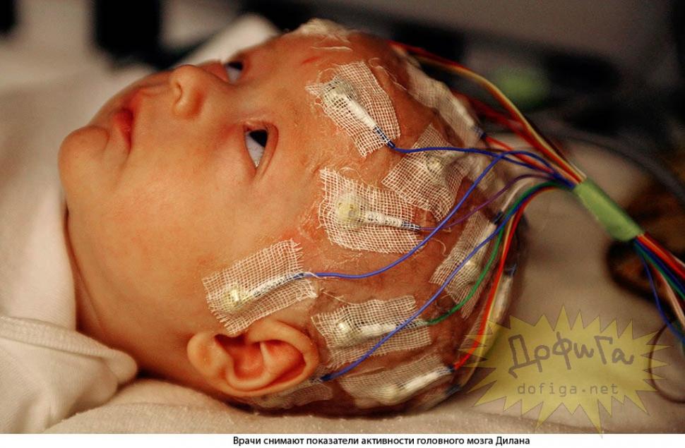 Povestea impresionantă a îngerului care a învins moartea. Luptă în fiecare secundă pentru a aduce speranţa 157536