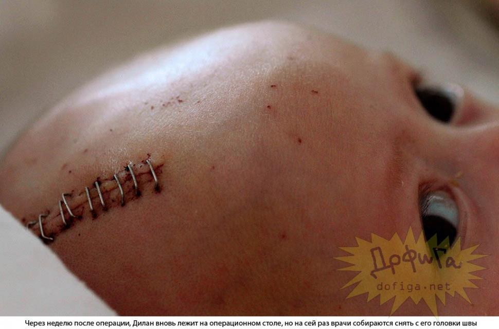 Povestea impresionantă a îngerului care a învins moartea. Luptă în fiecare secundă pentru a aduce speranţa 157540