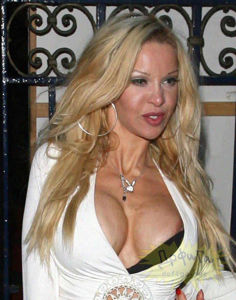 Ea este &quot;femeia din plastic&quot;. A făcut atâtea operaţii estetice, încât nu-şi mai simte sânii sau burta 158013