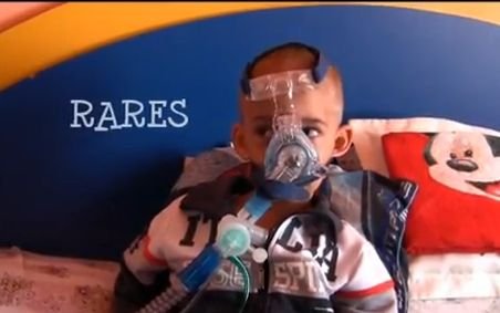 Dă o şansă la viaţă unui băieţel de 3 anişori care nu poate respira singur