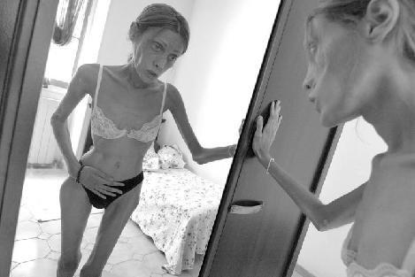 Imagini pe care nimeni nu le-a mai văzut. Tânăra care a murit pentru ca milioane de fete să trăiască 160154