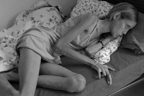 Imagini pe care nimeni nu le-a mai văzut. Tânăra care a murit pentru ca milioane de fete să trăiască 160158