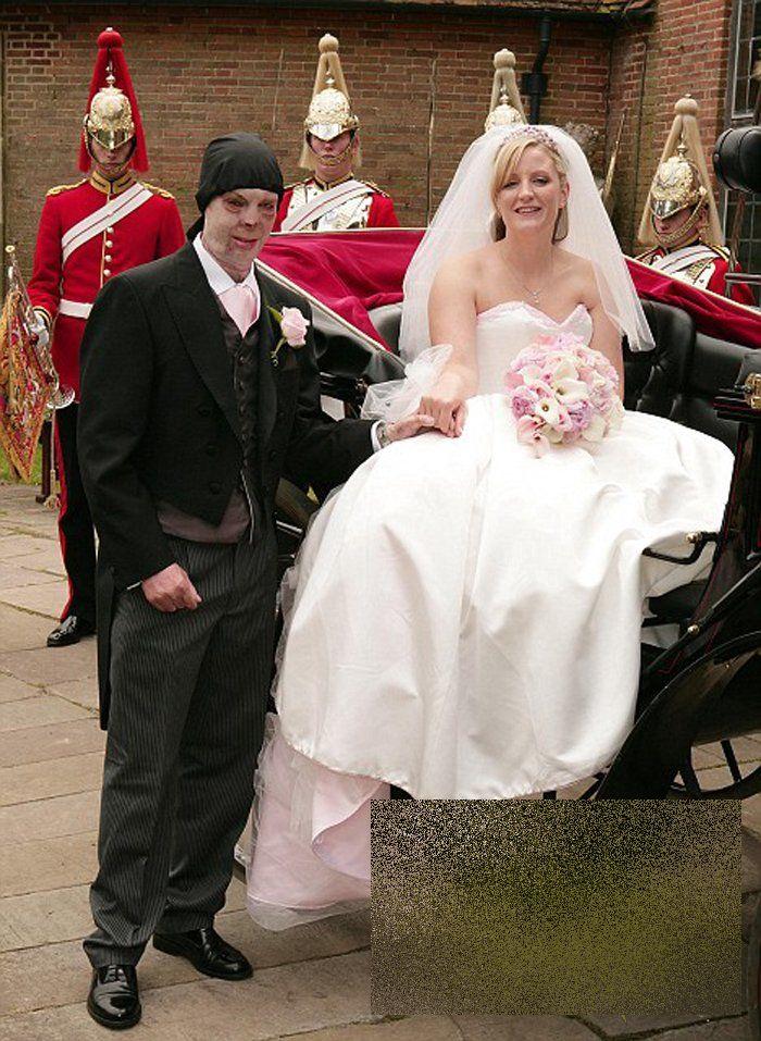 Nunta care a impresionat o planetă. Povestea lor de iubire a fost scrisă cu un sacrificiu imens 160216