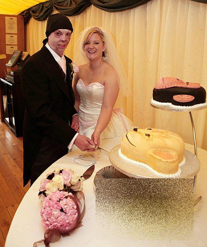 Nunta care a impresionat o planetă. Povestea lor de iubire a fost scrisă cu un sacrificiu imens 160217