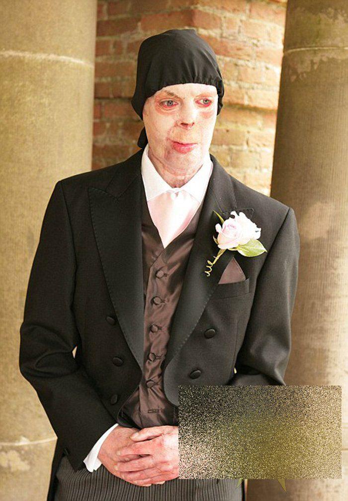 Nunta care a impresionat o planetă. Povestea lor de iubire a fost scrisă cu un sacrificiu imens 160218