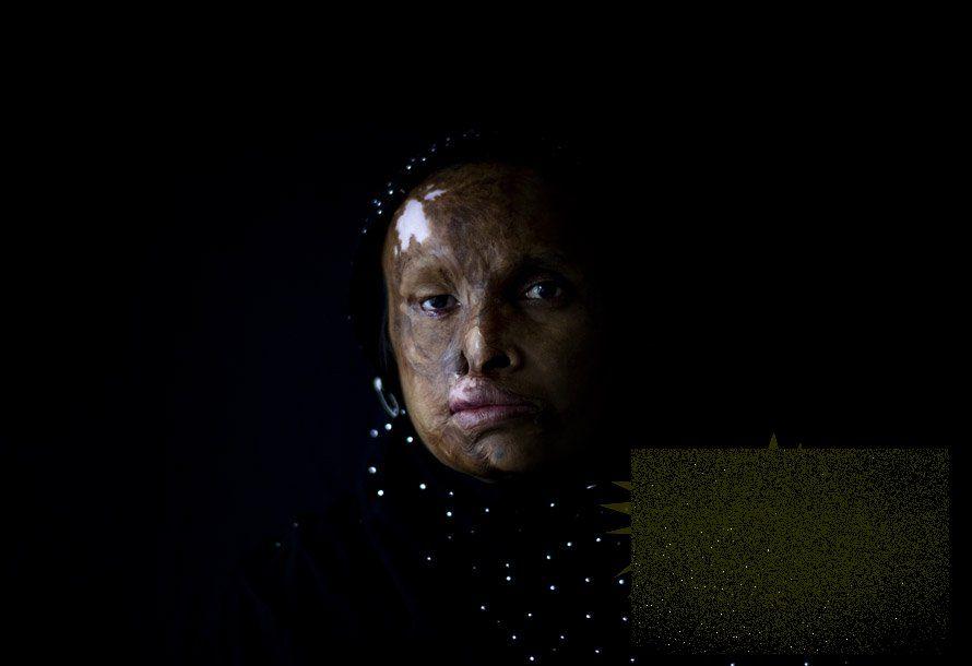 &quot;Nu mai putem plânge pentru că nu mai avem ochi. Nu mai putem râde pentru că nu mai avem gură&quot;. Locul unde femeile nu există 161912