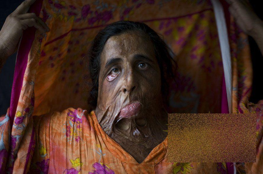 &quot;Nu mai putem plânge pentru că nu mai avem ochi. Nu mai putem râde pentru că nu mai avem gură&quot;. Locul unde femeile nu există 161913