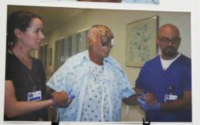 &quot;Pur şi simplu m-a sfâşiat. M-a muşcat de faţă. Mi-a scos ochii&quot;. Interviu cu victima canibalului din Florida 162492