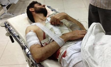 Fratele preşedintelui sirian Bashar Al-Assad şi-a pierdut ambele picioare într-un atentat