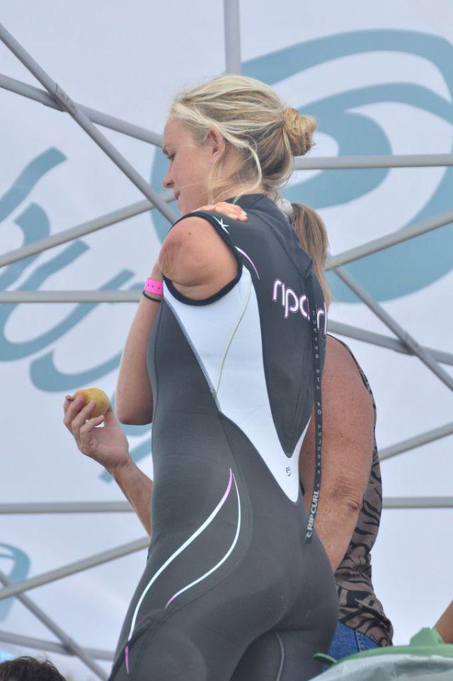 O blondă puternică. A revenit la surf după ce a fost aproape devorată de rechini 163186