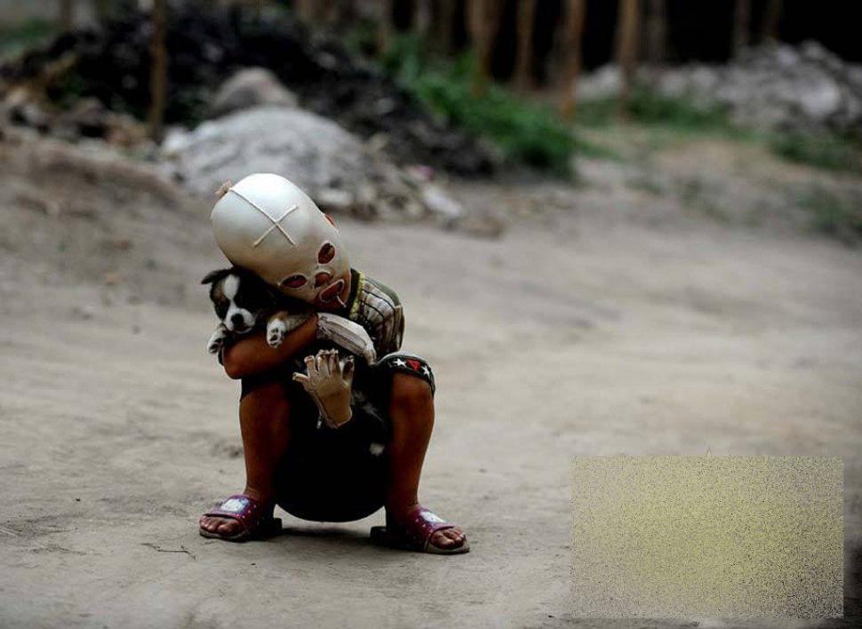 &quot;Viaţa este ca un zbor de fluturi&quot;. Imaginile care spun durerea copilului fără chip 163644