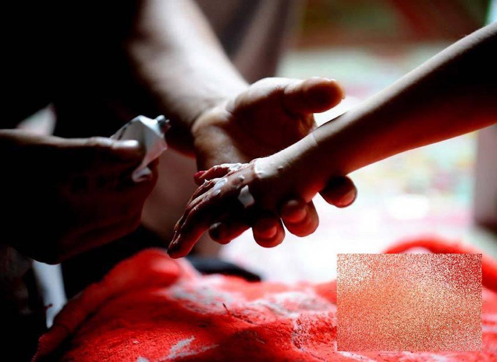 &quot;Viaţa este ca un zbor de fluturi&quot;. Imaginile care spun durerea copilului fără chip 163645