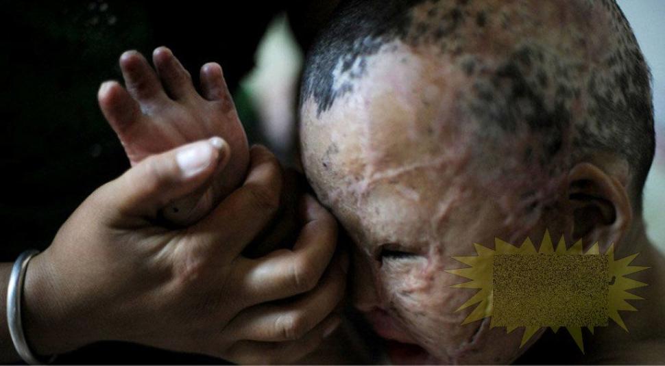 &quot;Viaţa este ca un zbor de fluturi&quot;. Imaginile care spun durerea copilului fără chip 163647