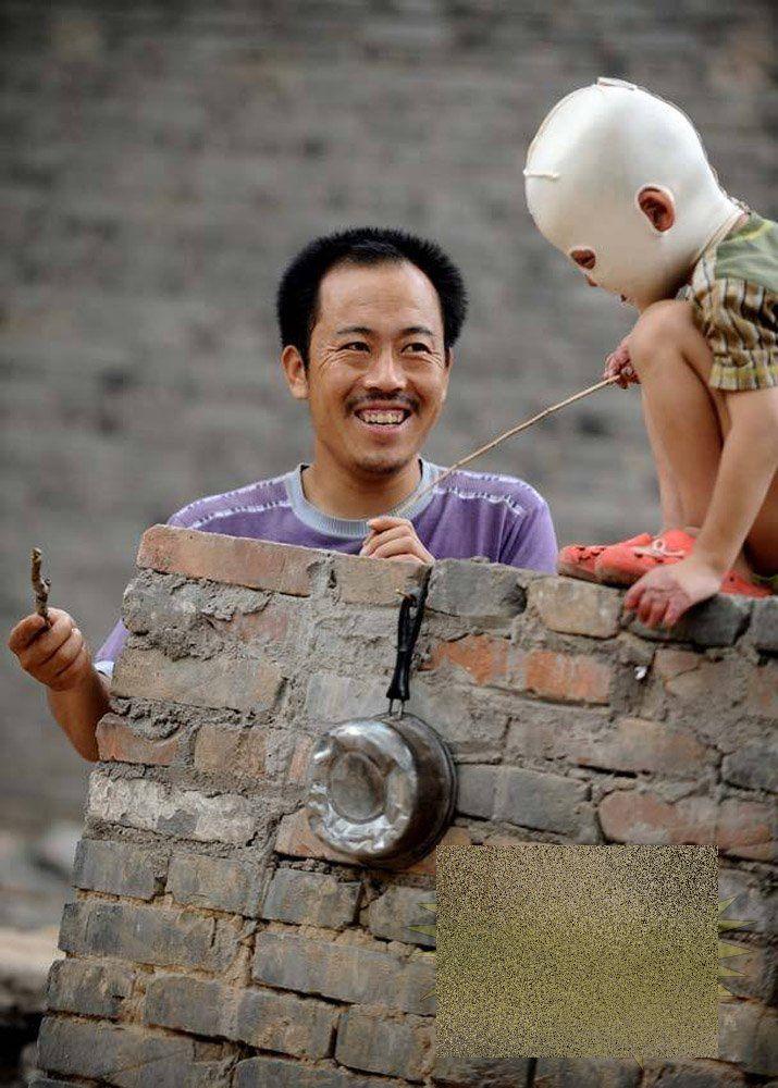 &quot;Viaţa este ca un zbor de fluturi&quot;. Imaginile care spun durerea copilului fără chip 163650