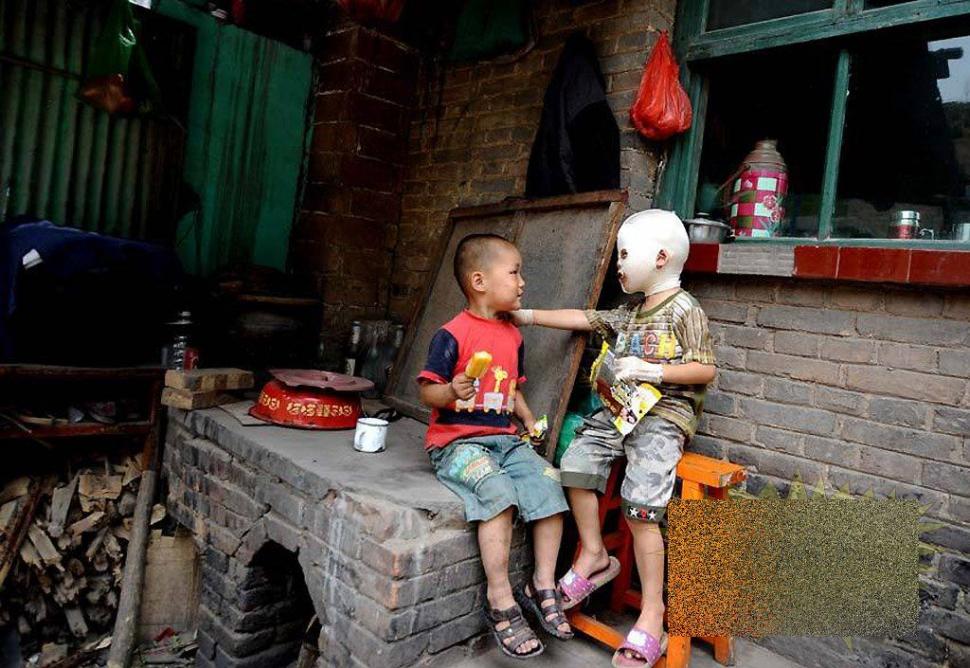 &quot;Viaţa este ca un zbor de fluturi&quot;. Imaginile care spun durerea copilului fără chip 163652