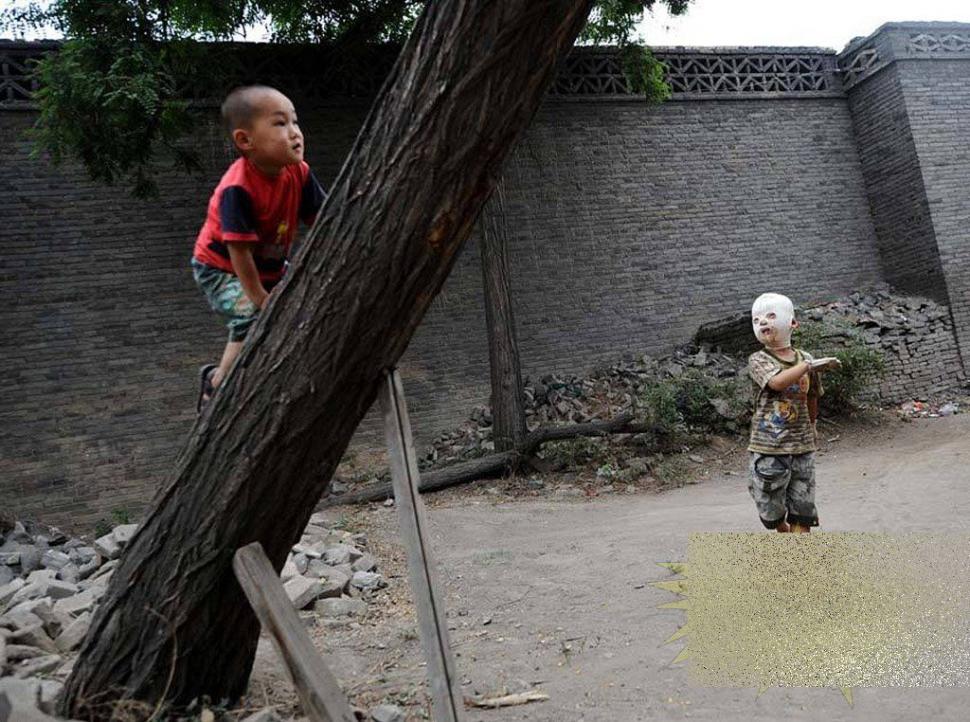 &quot;Viaţa este ca un zbor de fluturi&quot;. Imaginile care spun durerea copilului fără chip 163653