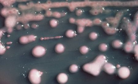 Bacteria ucigaşă revine. Şase persoane au murit în urma contaminării cu E. coli