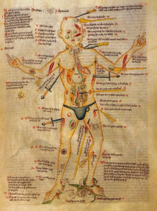Are răni în toate părţile corpului. Imaginile din Evul Mediu care au călăuzit medicina de-a lungul secolelor 165939