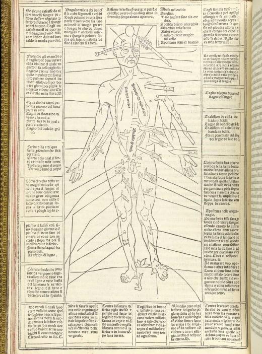 Are răni în toate părţile corpului. Imaginile din Evul Mediu care au călăuzit medicina de-a lungul secolelor 165942
