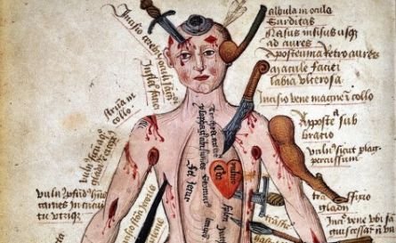 Are răni în toate părţile corpului. Imaginile din Evul Mediu care au călăuzit medicina de-a lungul secolelor