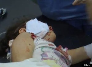 Imagini ŞOCANTE din Siria! O fetiţă de 4 ani a fost împuşcata de un lunetist