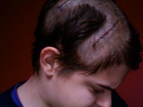 “Trăieşte din nou sau mori încercând”. Criogenia, ultima speranţă pentru o tânără de 23 de ani  166395