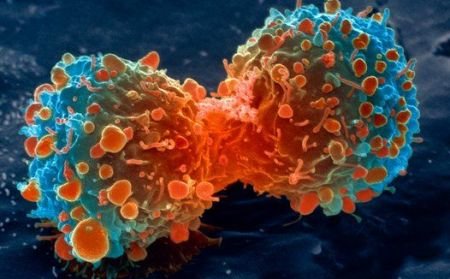 Descoperire revoluţionară în tratamentul cancerului. Molecula distruge numai celulele canceroase