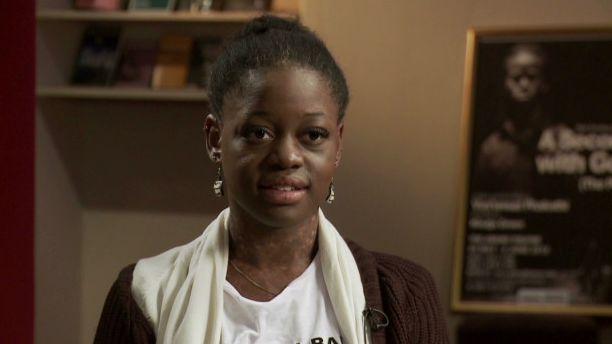 „Am scăpat dintr-un loc groaznic. Acum îmi trăiesc visul în fiecare zi&quot;. Lebăda neagră a baletului american 172538