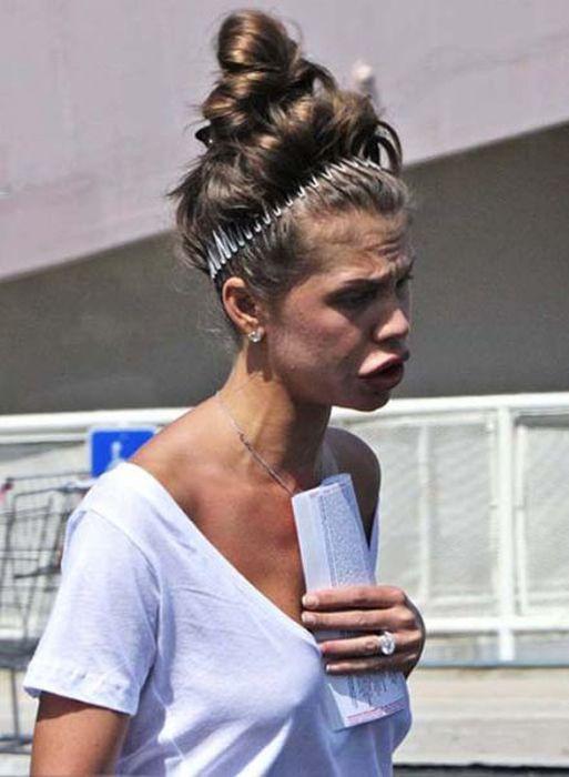 Arată de parcă i-ar fi trecut trenul peste faţă. Când chirurgia estetică i-a transformat în monştri, din oameni normali 176929