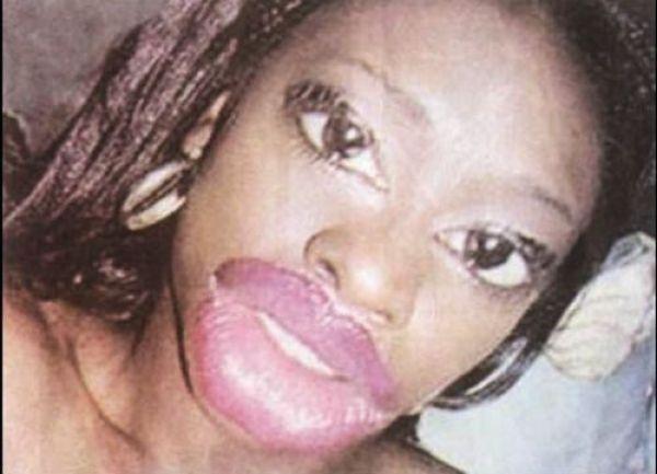 Arată de parcă i-ar fi trecut trenul peste faţă. Când chirurgia estetică i-a transformat în monştri, din oameni normali 176931