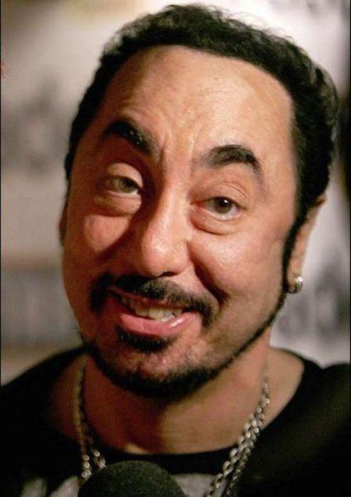 Arată de parcă i-ar fi trecut trenul peste faţă. Când chirurgia estetică i-a transformat în monştri, din oameni normali 176933