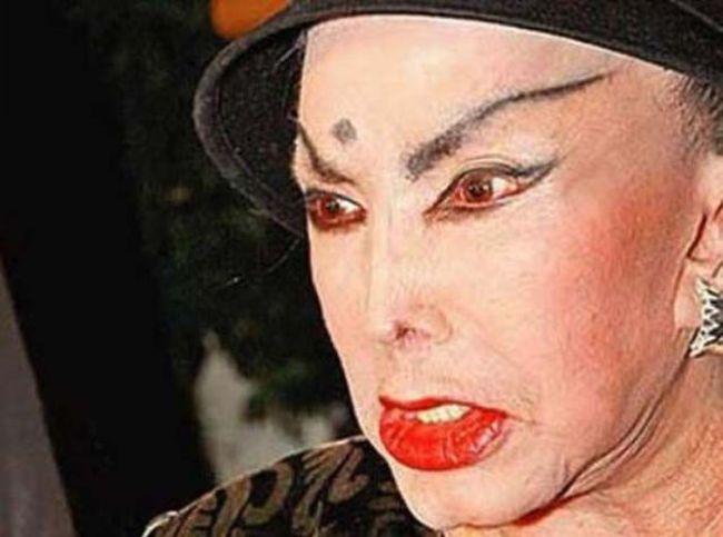 Arată de parcă i-ar fi trecut trenul peste faţă. Când chirurgia estetică i-a transformat în monştri, din oameni normali 176934