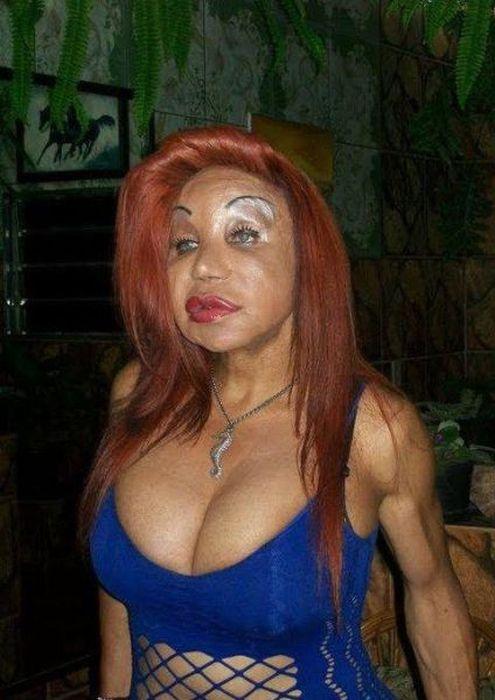 Arată de parcă i-ar fi trecut trenul peste faţă. Când chirurgia estetică i-a transformat în monştri, din oameni normali 176935