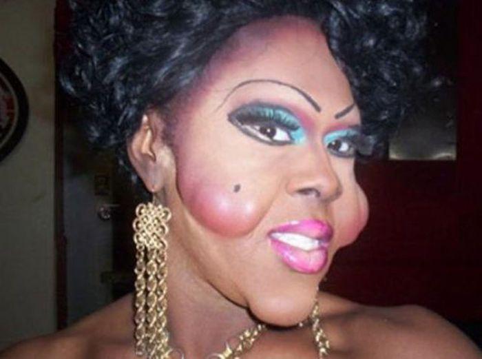 Arată de parcă i-ar fi trecut trenul peste faţă. Când chirurgia estetică i-a transformat în monştri, din oameni normali 176936