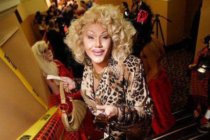 Arată de parcă i-ar fi trecut trenul peste faţă. Când chirurgia estetică i-a transformat în monştri, din oameni normali 176937