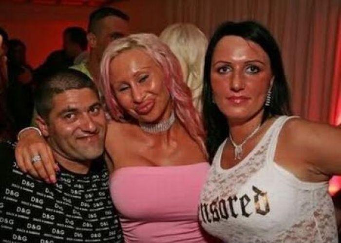 Arată de parcă i-ar fi trecut trenul peste faţă. Când chirurgia estetică i-a transformat în monştri, din oameni normali 176938