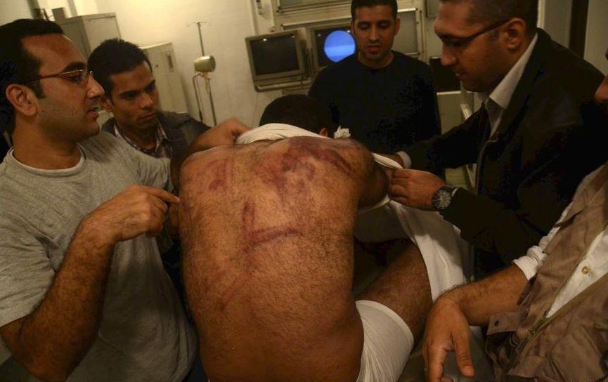 UN MILION  de oameni au protestat în Egipt. Pe străzile din Cairo s-a dezlănţuit dezastrul. Sute de manifestanţi au fost răniţi 180279