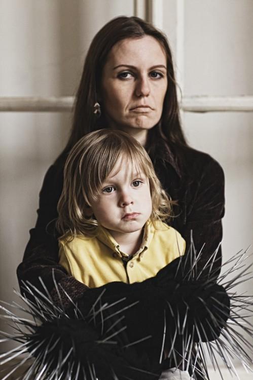 Niciun părinte n-a rămas indiferent la aceste imagini. FOTOREPORTAJ impresionant cu suferinţele copiilor 181846